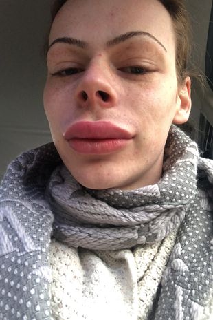 Patrik nije zadovoljan
